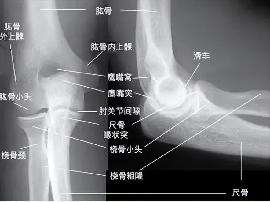 在做冲击波治疗前可以打封闭吗,冲击波治疗网球肘有效吗