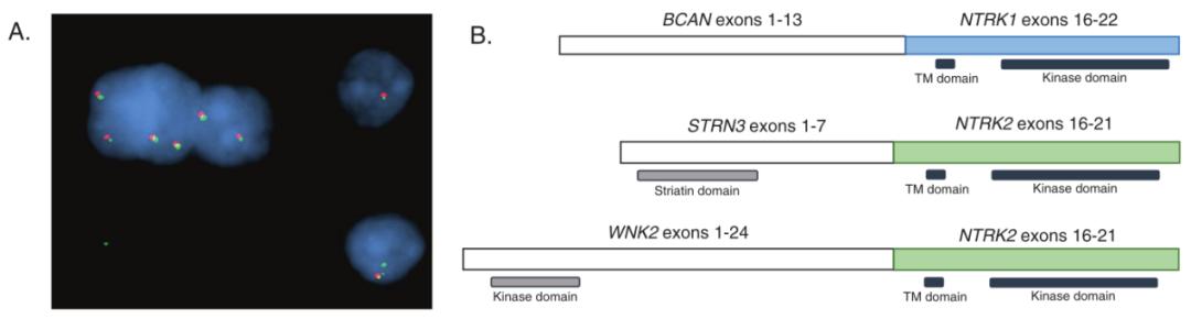 文献学习||靶向BCAN-NTRK1融合治疗脑胶质瘤的临床和影像学反应