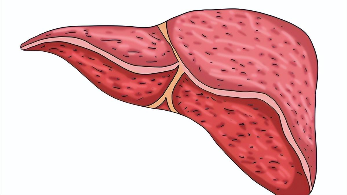 谷丙转氨酶高怎么回事是什么病,谷丙转氨酶高怎么回事严重吗