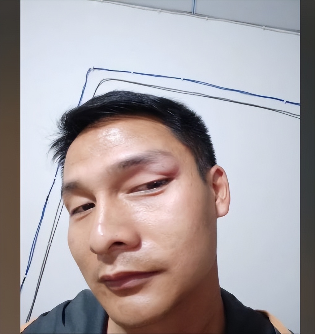 蜜蜂振翅被蛰,男子带狗子近距离观察蜜蜂被蛰