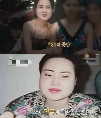 315晚会曝光医美行业三大乱象，难怪这4位明星，整容最终变毁容