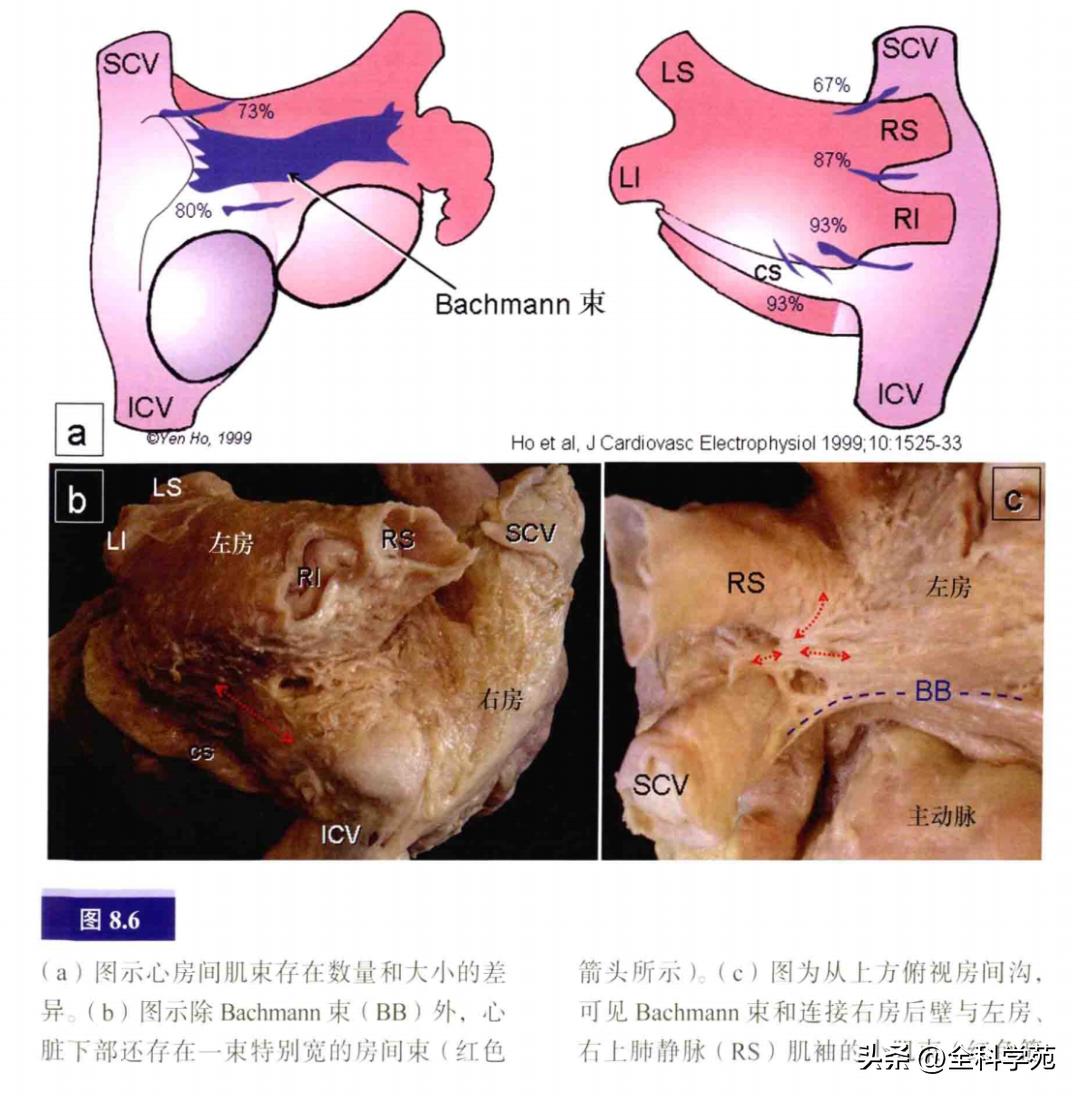 连接左心房的是肺静脉吗,左心房与肺静脉解剖