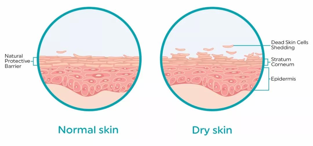 什么是干性护肤品,干性皮肤和混干性皮肤的区别