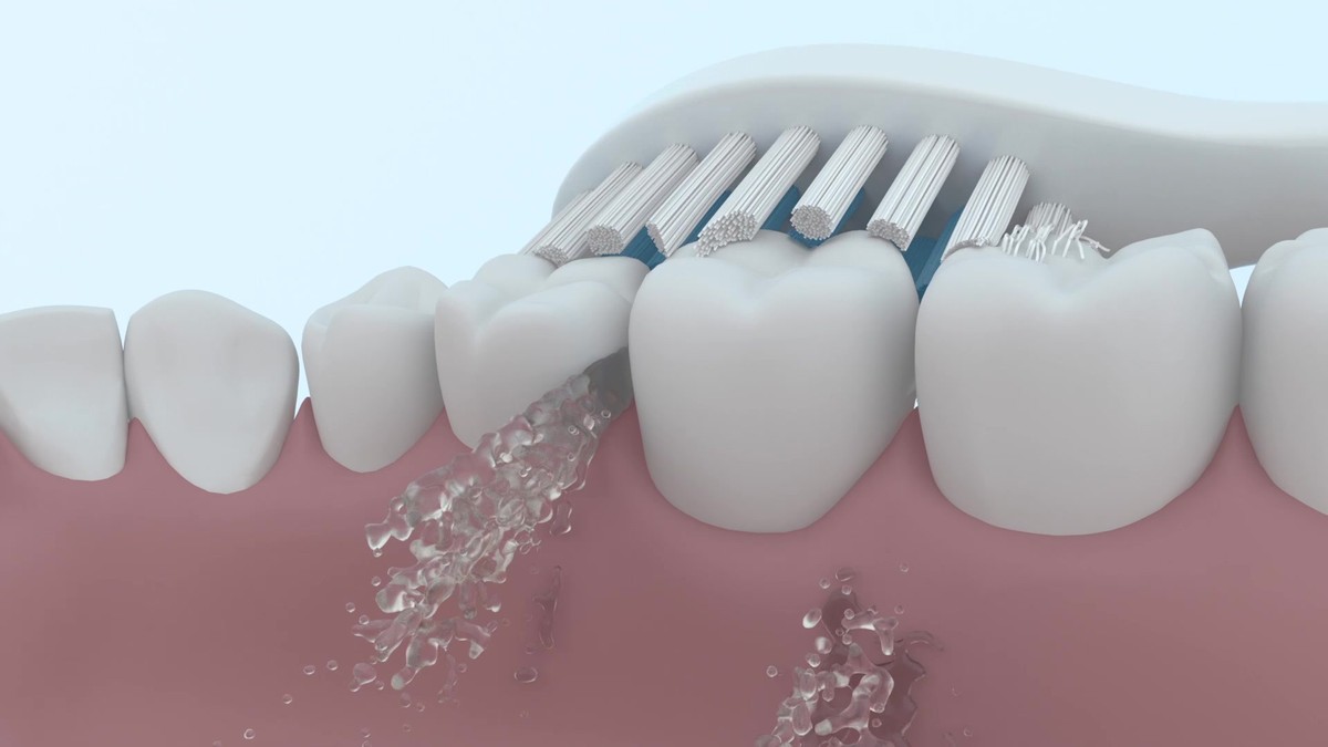 usmile电动牙刷和小米t700哪个好,飞利浦电动牙刷hx6730和hx6721