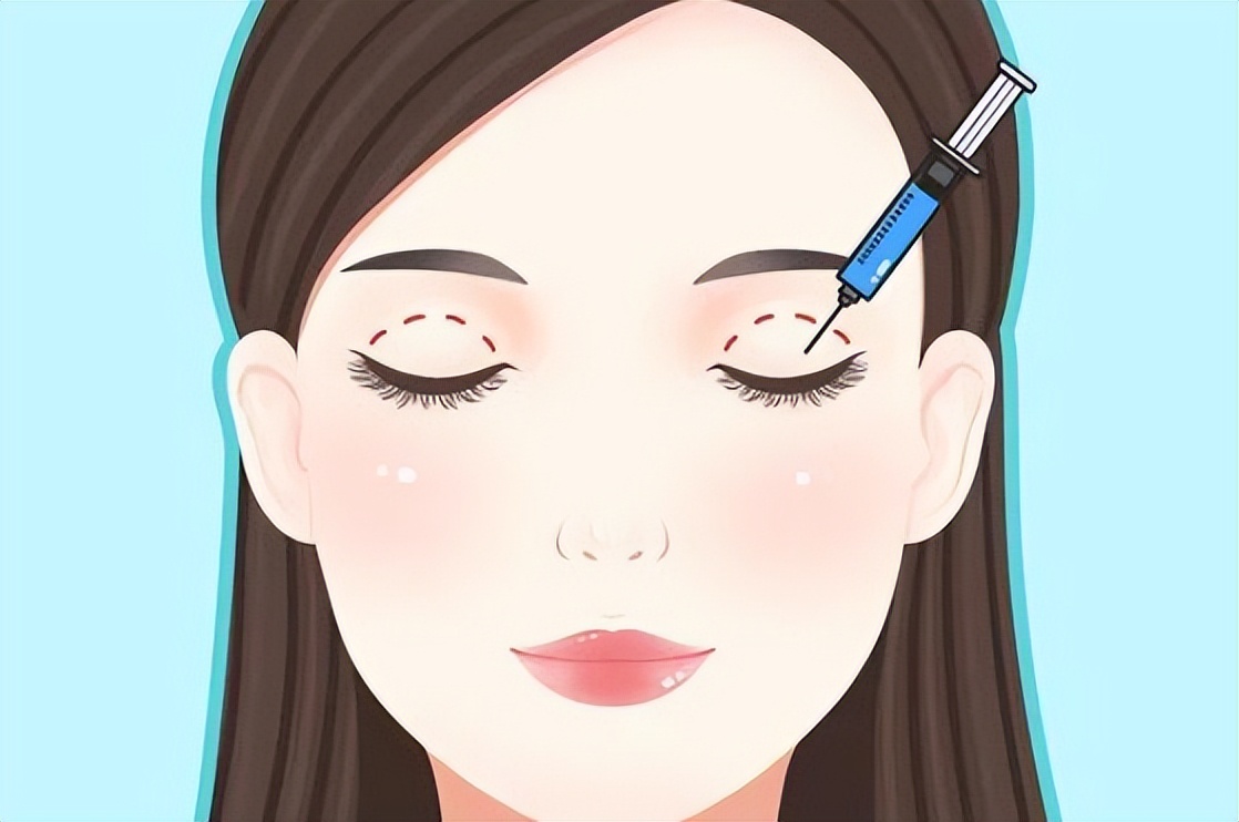 双眼皮怎么做又省钱又好看,做双眼皮的10个常识