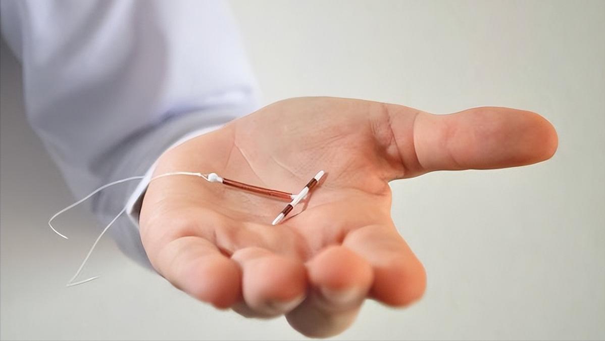 女人身体里的节育环不取出来行吗,女性身体里的节育环