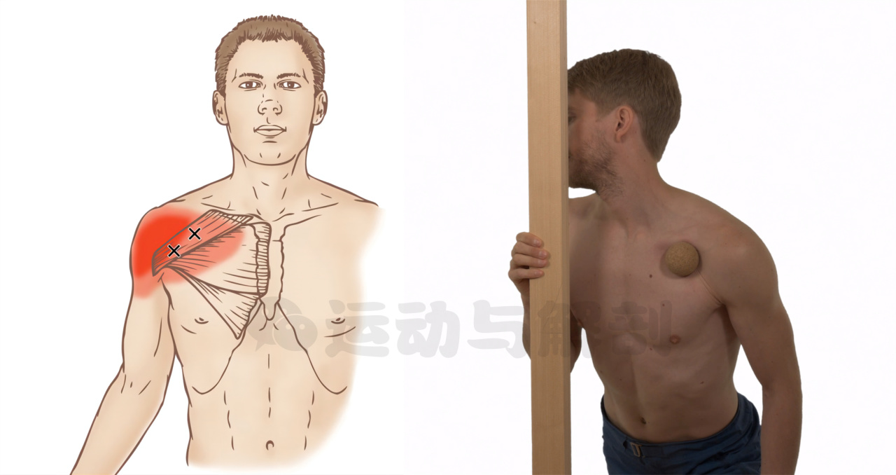 胸大肌紧绷不舒服怎么调理,胸大肌紧绷是什么原因