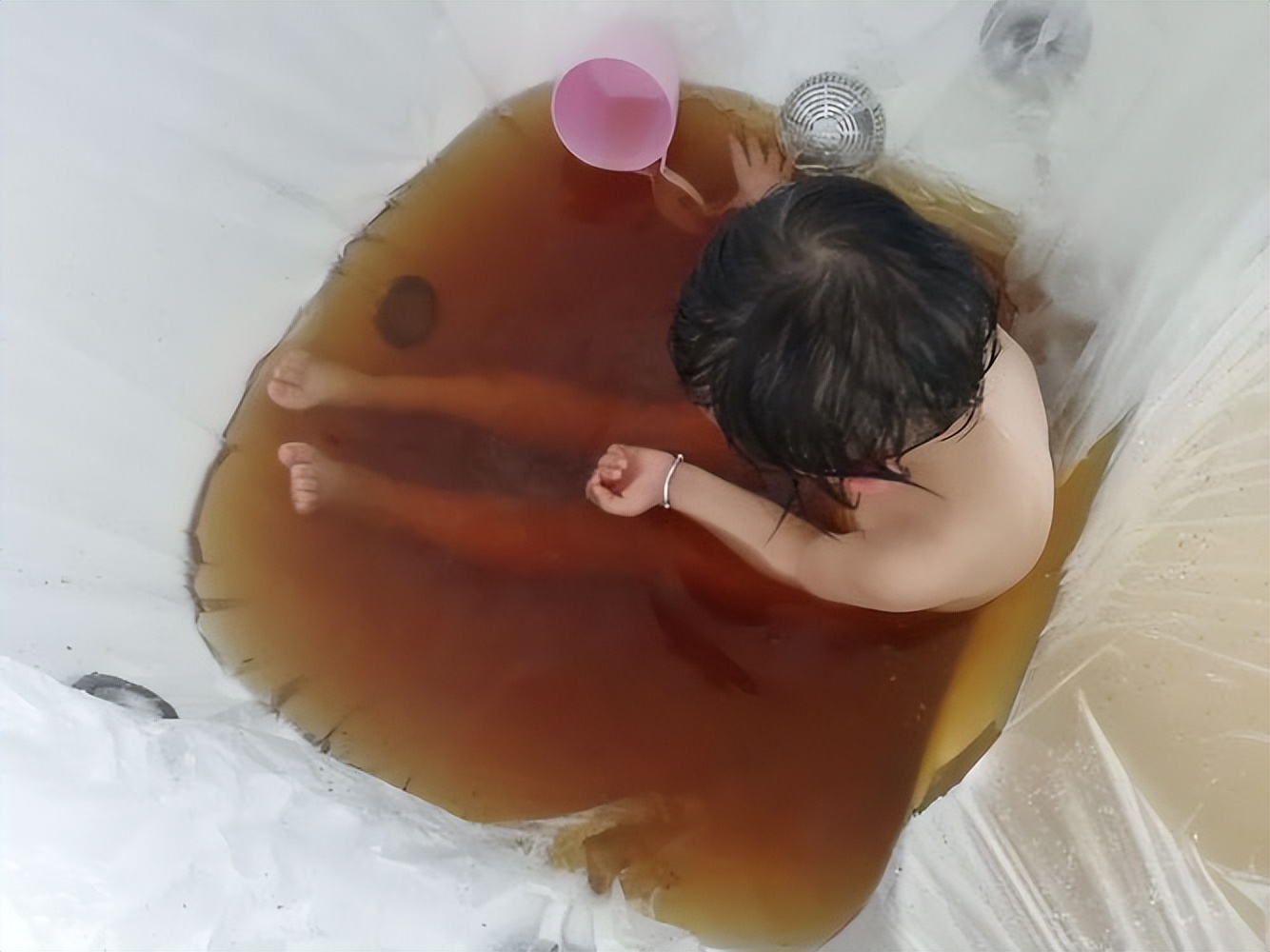 肛周脓肿中医三黄膏,紫草膏可以治肛周脓肿吗