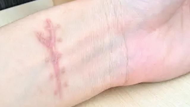 灏忎紮杞荤敓19宀佸皯濂崇尞鍒濆惢,19宀佸皬浼欒交鐢熷皯濂崇尞鍒濆惢