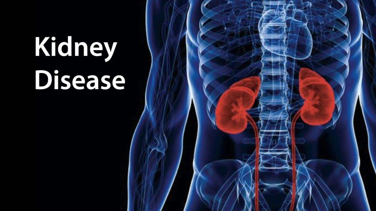 一招判断腰疼还是肾疼图解,右侧肾疼腰疼是什么原因