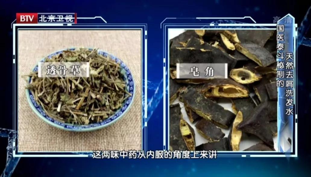 头皮屑多洗发水不应该有什么成分,头皮屑越洗越多真的只怪洗发水吗