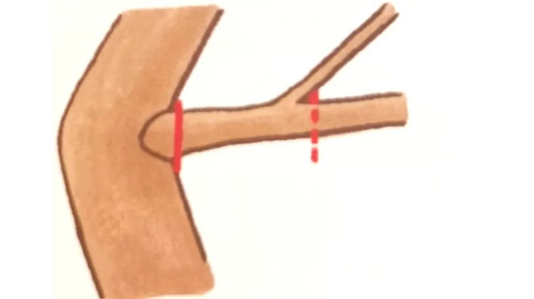 榆树盆景鸡爪枝修剪,映山红盆景花后怎样修剪枝