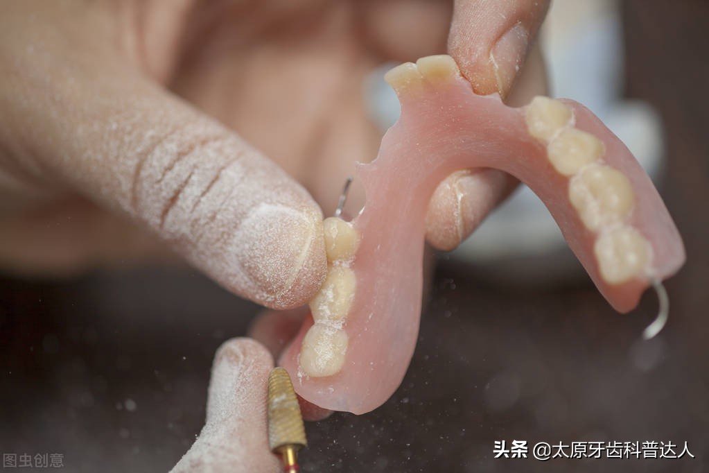 缺牙怎么办选择哪种镶牙方式,牙缺失哪种镶牙方式最好