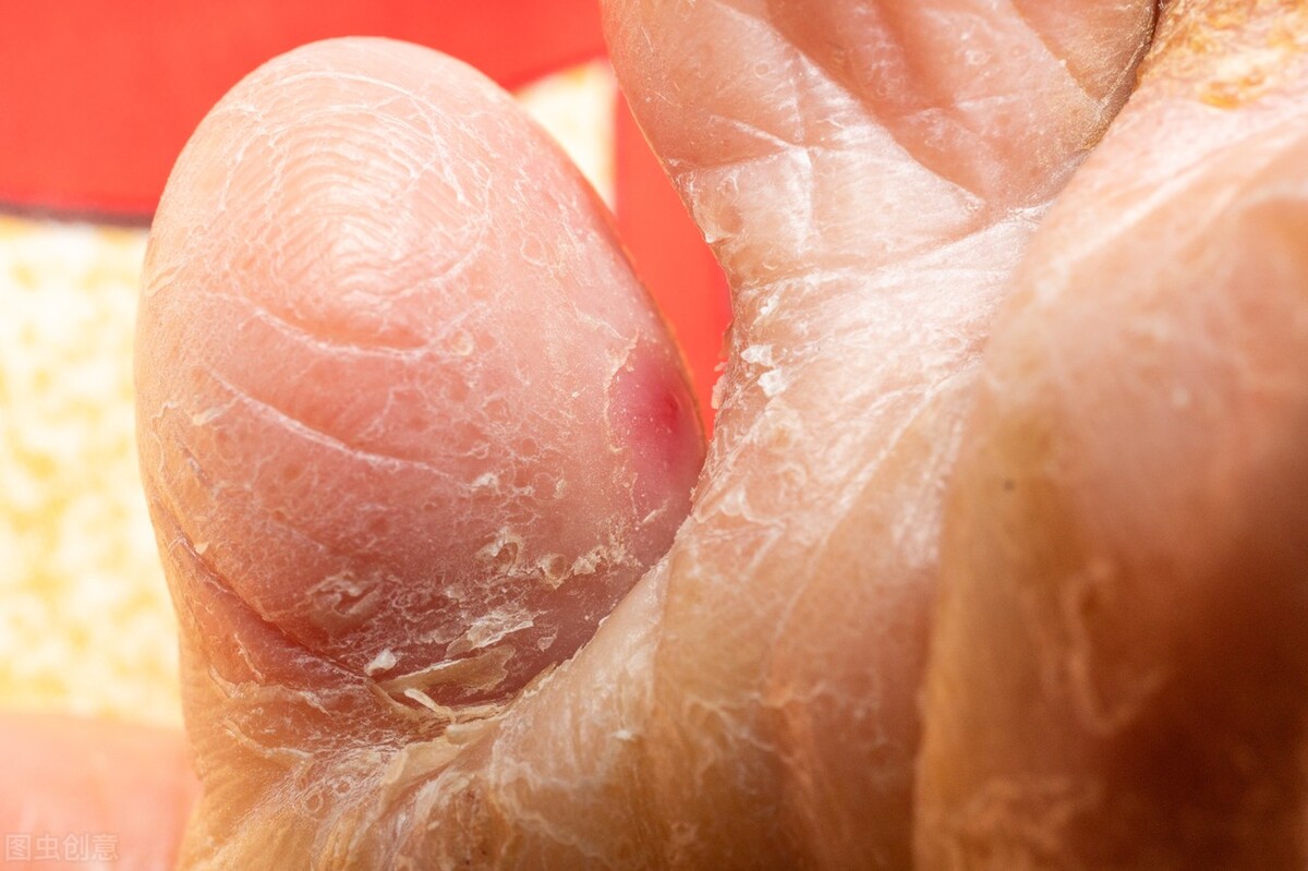 济世良方治脚气,治脚气古方