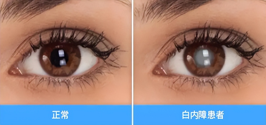 年纪大了看不清能戴老花镜吗,年纪大了看不见眼睛