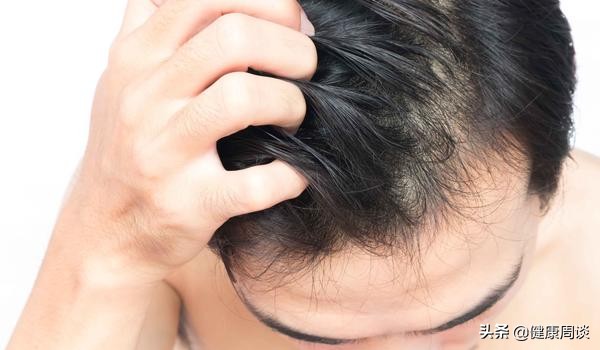 硫磺皂能洗头吗有什么作用,硫磺皂洗头有哪些危害