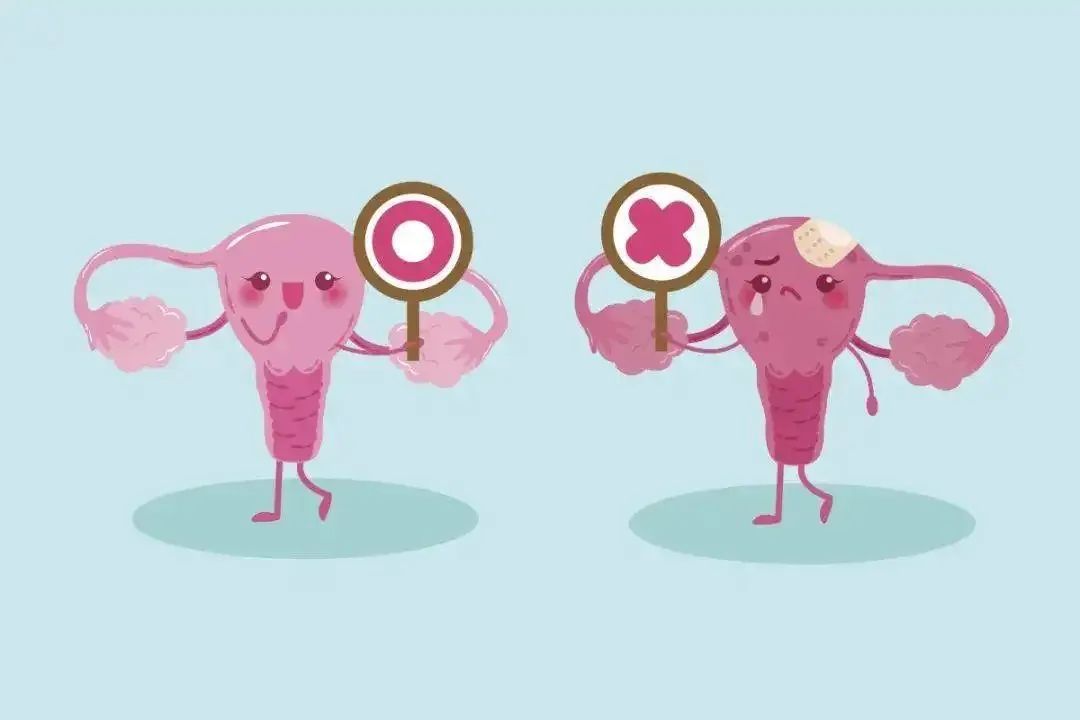 妇科听起来可怕实际没事的病名,妇科听起来吓人的病