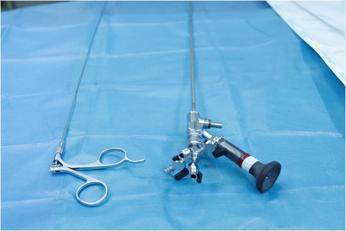 为什么输尿管结石突然发作,输尿管结石一般怎么引起