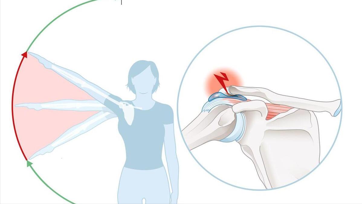 纵隔肿瘤会引起后背肩胛骨痛,右侧背部肩胛骨疼是癌症早期信号