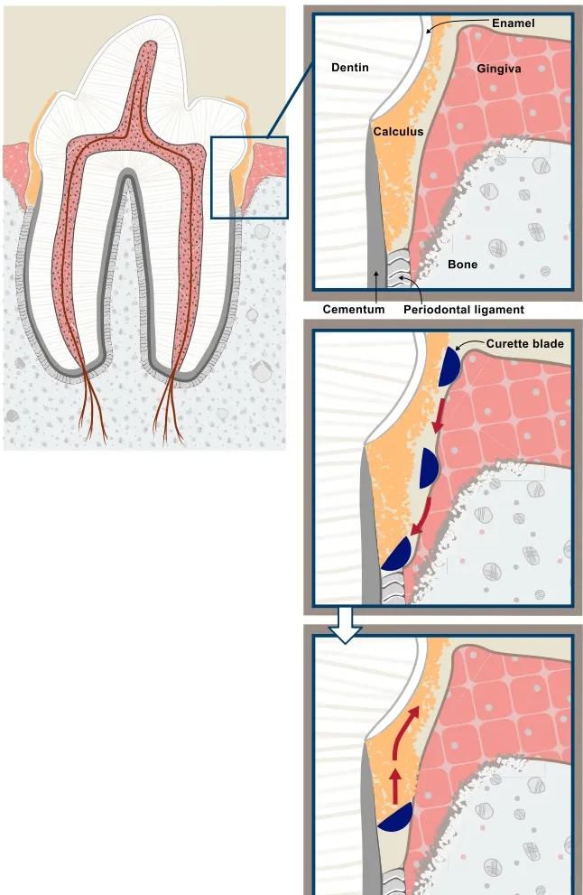 不麻醉怎么给猫洗牙,犬猫洗牙的方法步骤及注意事项