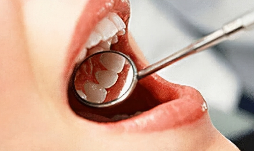 口腔癌的4个早期症状表现,口腔癌早期的五大信号