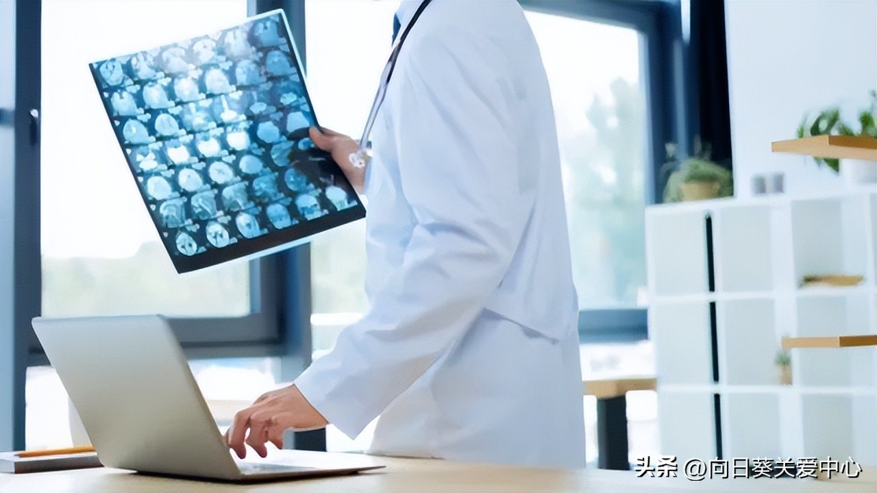 儿童癫痫患者的最佳治疗方法,儿童癫痫越早治疗越容易好吗