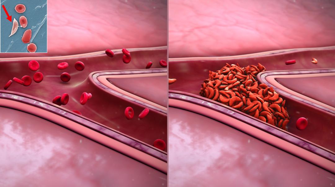 分享一些人类还在演化的好消息，比如我们正在失去智齿丨说点人事