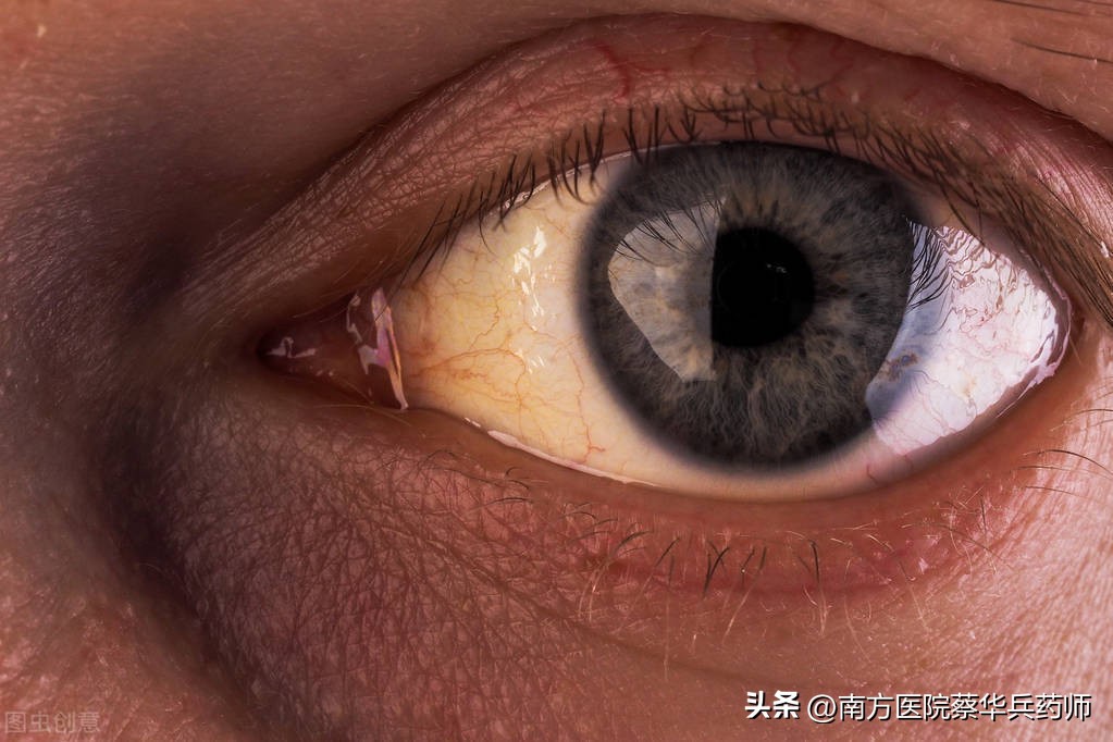 过路黄是清热解毒吗,过路黄草药可以去结石吗