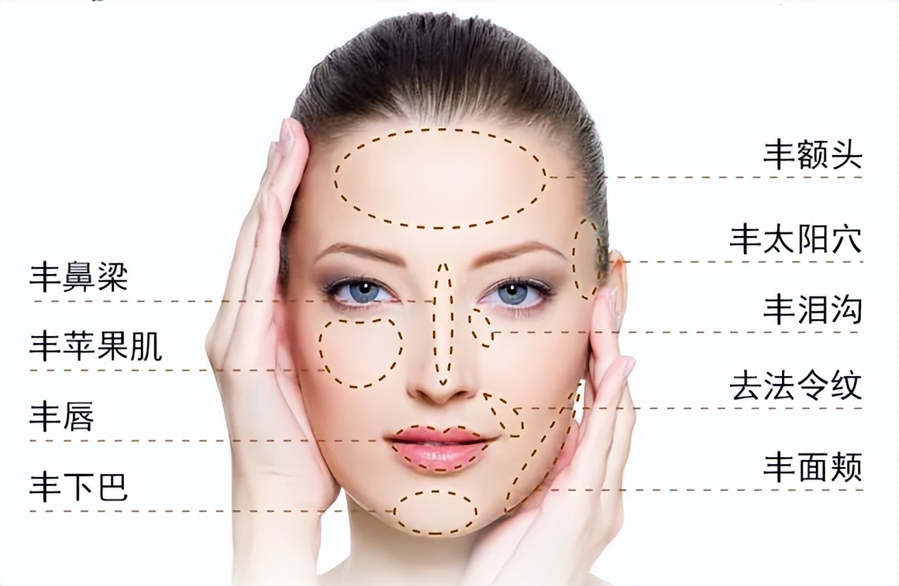 面部填充失败案例,脂肪填充面部失败案例