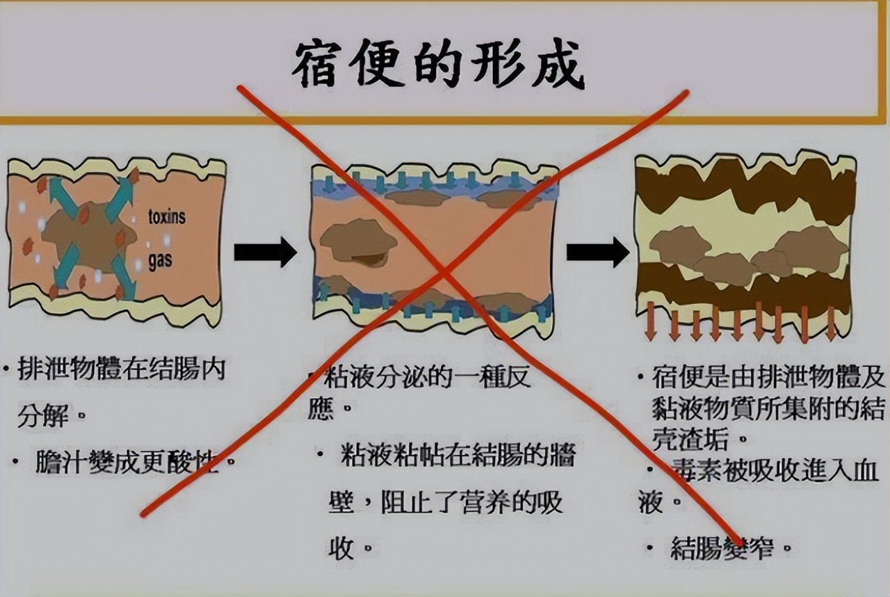 什么叫宿便肠道中的粪便,人体有几斤宿便