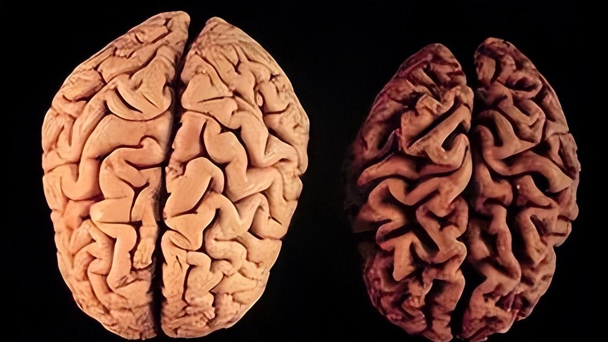 小孩检查脑ct有危害吗,年龄大了查血查什么好