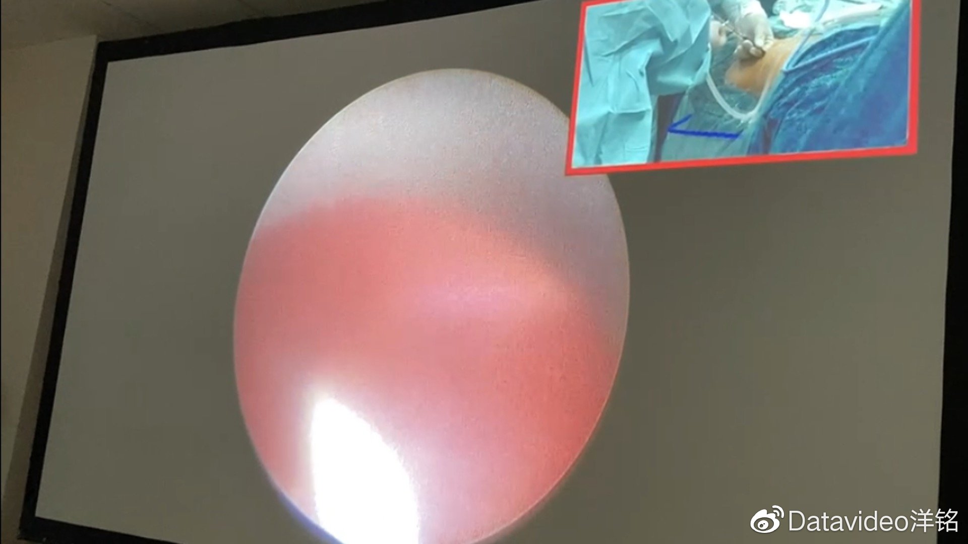 中部战区总医院汉口院区首次手术直播研讨微论坛是如何实现的？