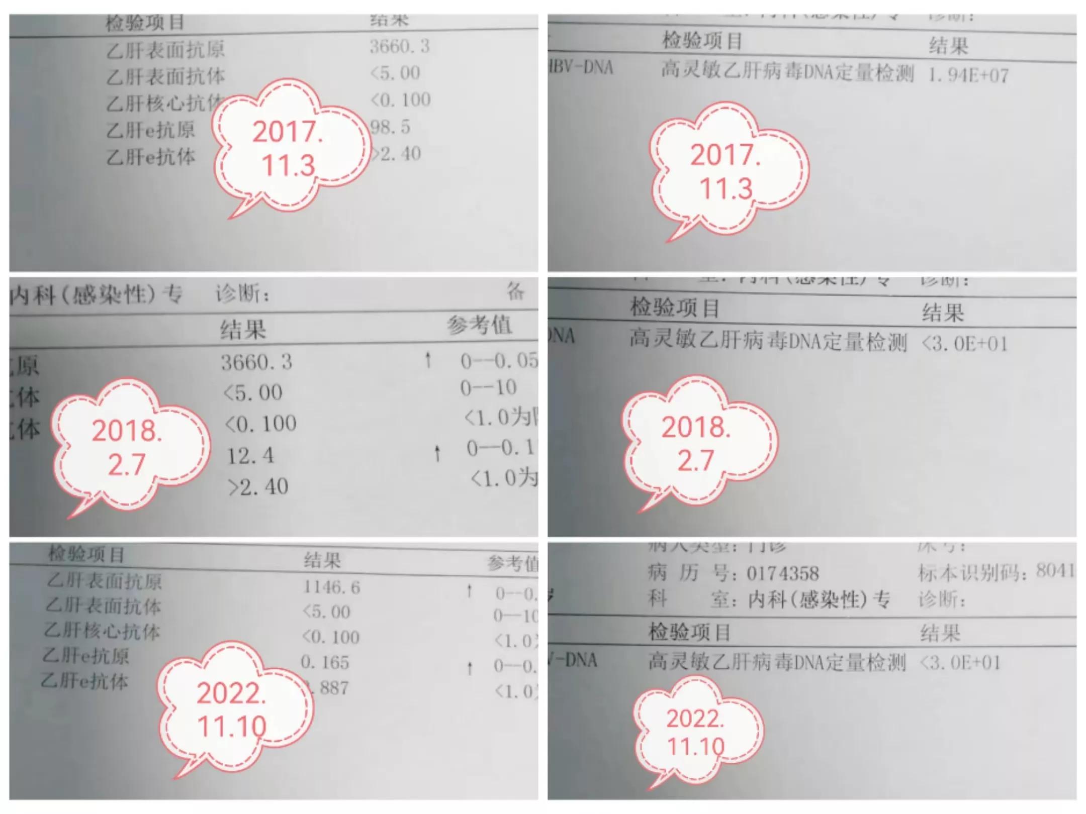 服恩替卡韦多久耐药,服用恩替卡韦多久大三阳转阴