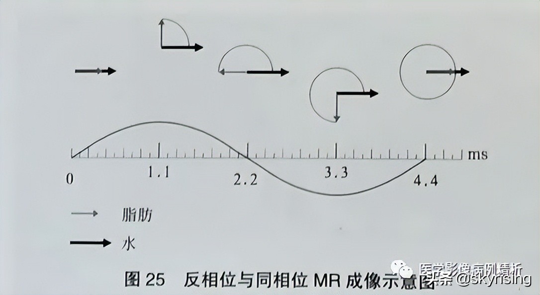 老年女性骶骨受侵椎管骶管内富血供占位影诊思维过程