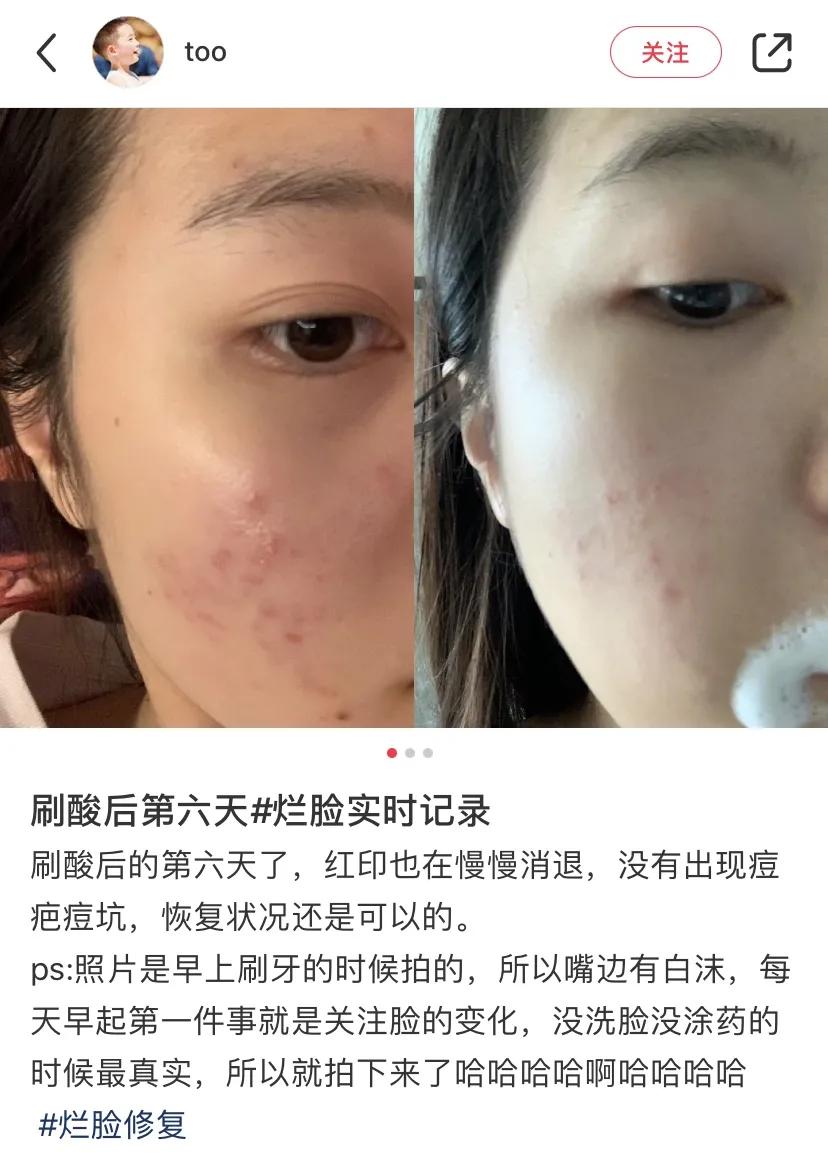 护肤毁脸的十大误区,护肤烂脸