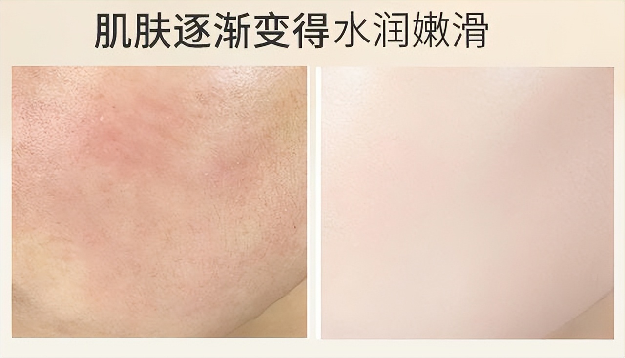 屈臣氏补水保湿水乳便宜又好用,屈臣氏专柜的兰蔻为什么便宜