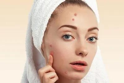 脸部皮肤严重损伤了怎么办,脸部皮肤受损了怎么办