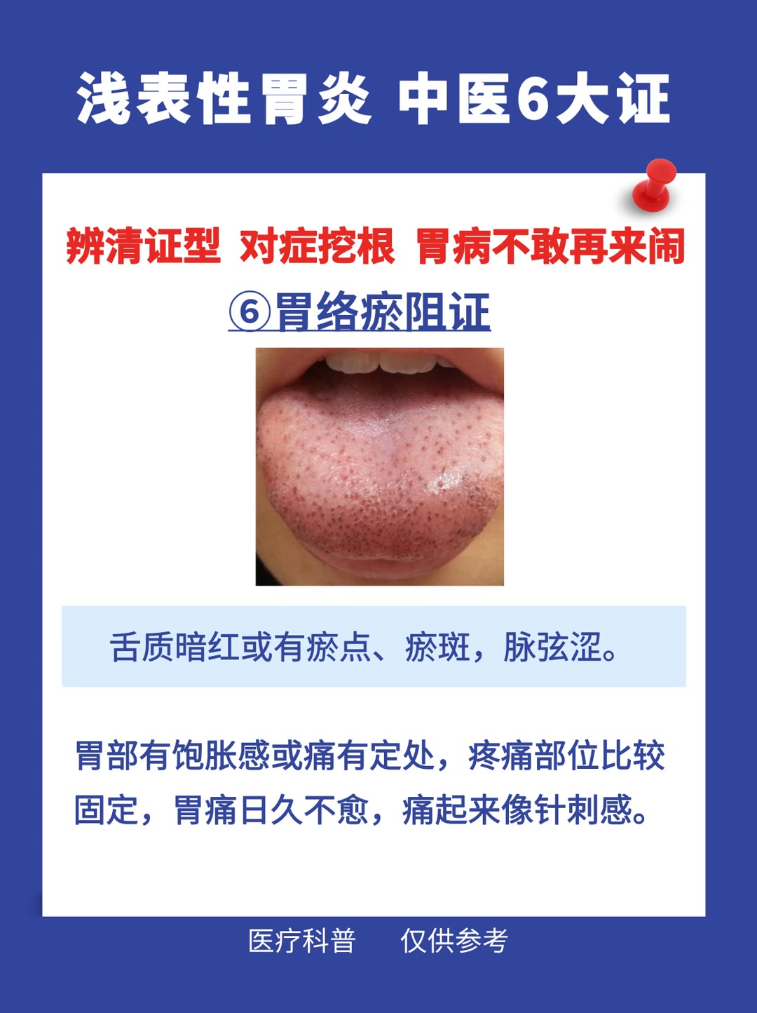 慢性浅表性胃炎中医治疗药方,浅表性胃炎中医判断