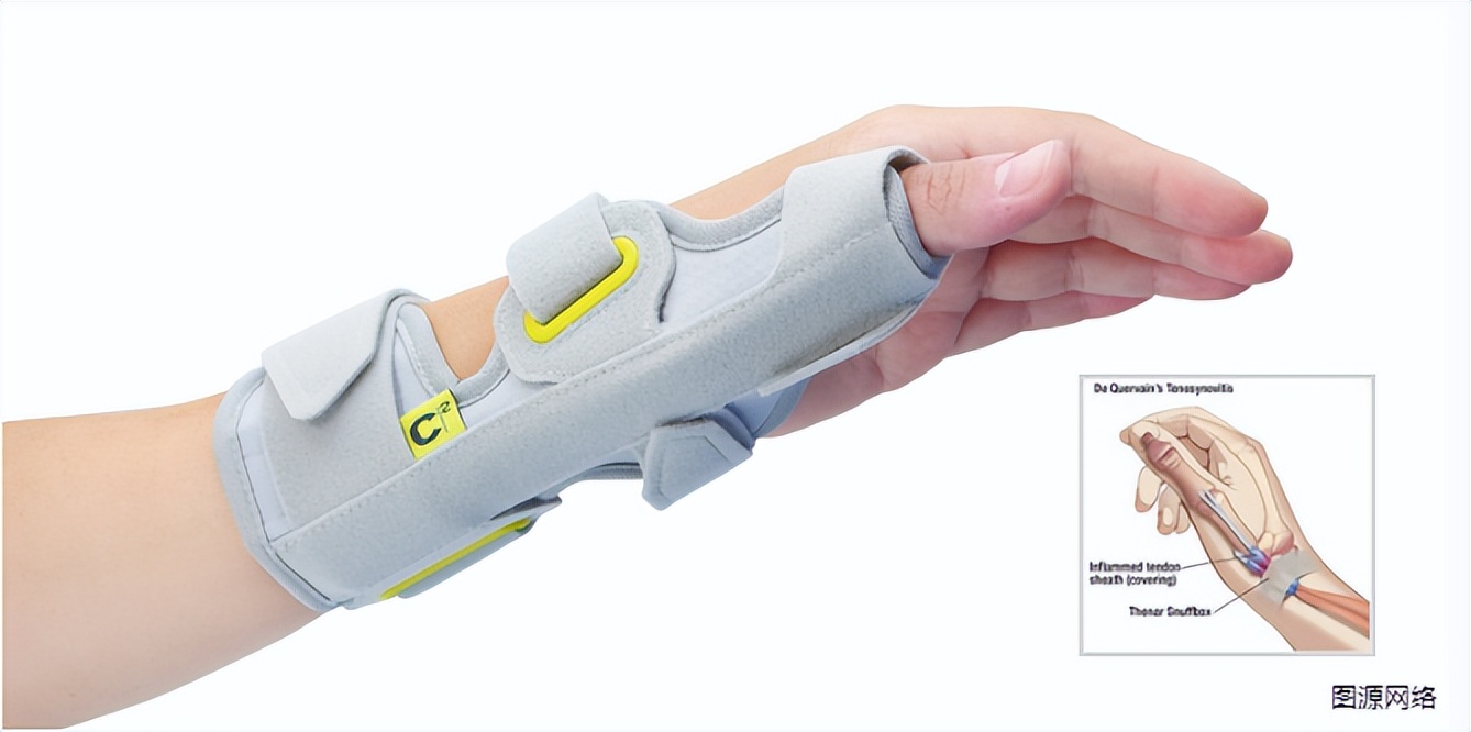 预防腱鞘炎,使用键盘的正确姿势防腱鞘炎