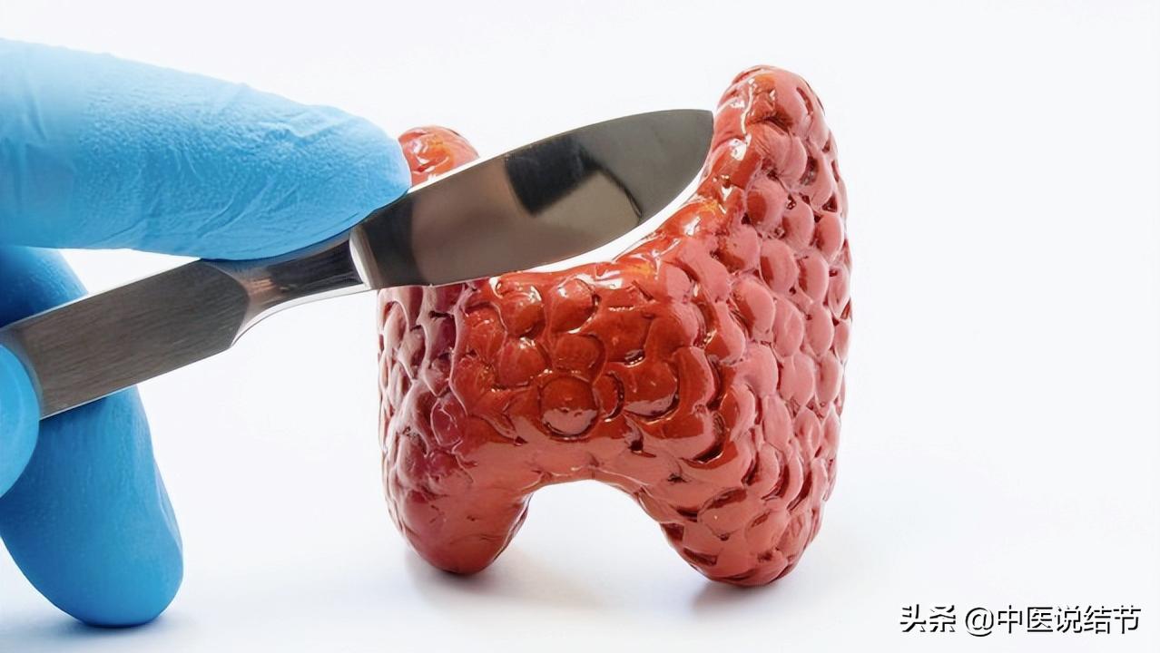 甲状腺结节表现在颈部什么地方,目前治疗甲状腺结节的最有效方法