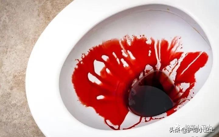 便血别担心不一定是直肠癌,便血不一定是肠癌吗