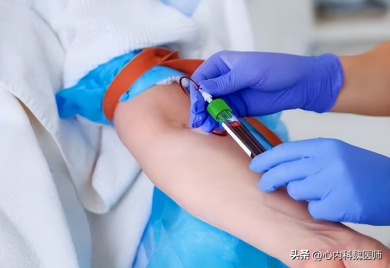 脂蛋白a升高有什么危险,高密度脂蛋白偏低和脂蛋白a偏高