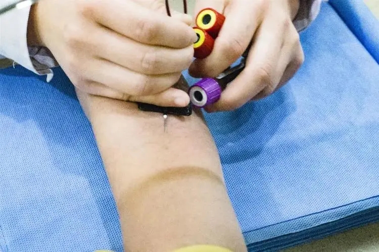 黄芪是伤肾的吗,黄芪伤肾怎么回事