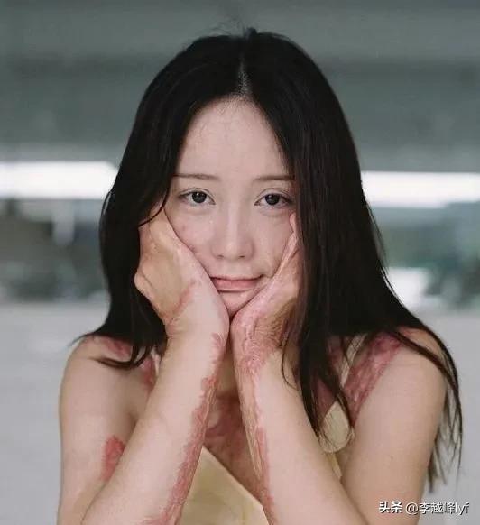 被泼了硫酸要赶紧用水洗吗,泼硫酸被泼用什么自救