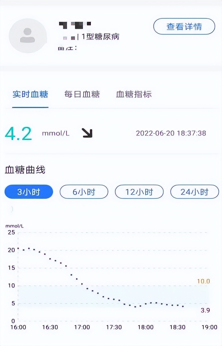 新技术与精准医学,血糖监测最新设备