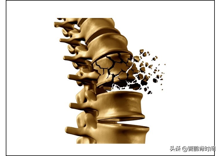 腰突游泳注意事项,腰突游泳要注意些什么