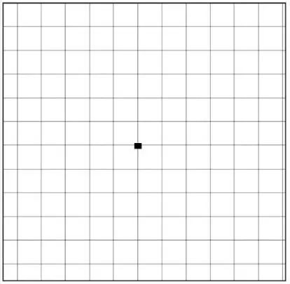 眼睛长黄斑怎么去除,黄斑是黑眼球还是白眼球