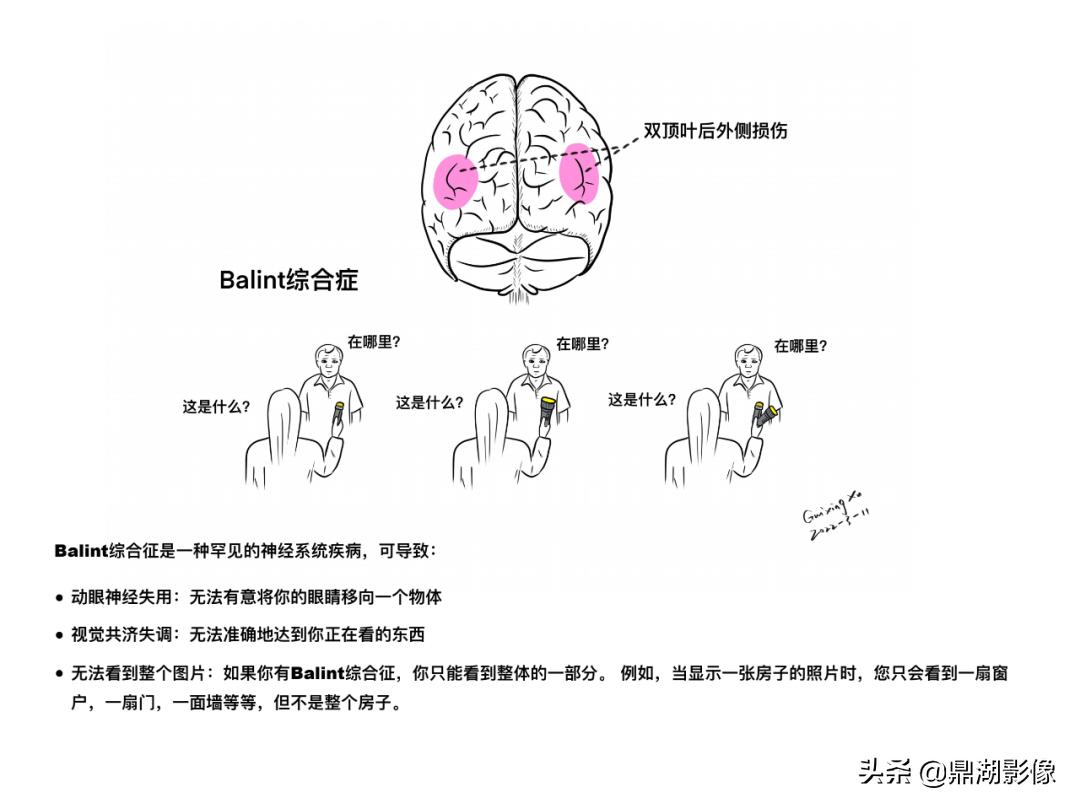 大脑皮层的解剖与定位,大脑解剖学习绘图笔记
