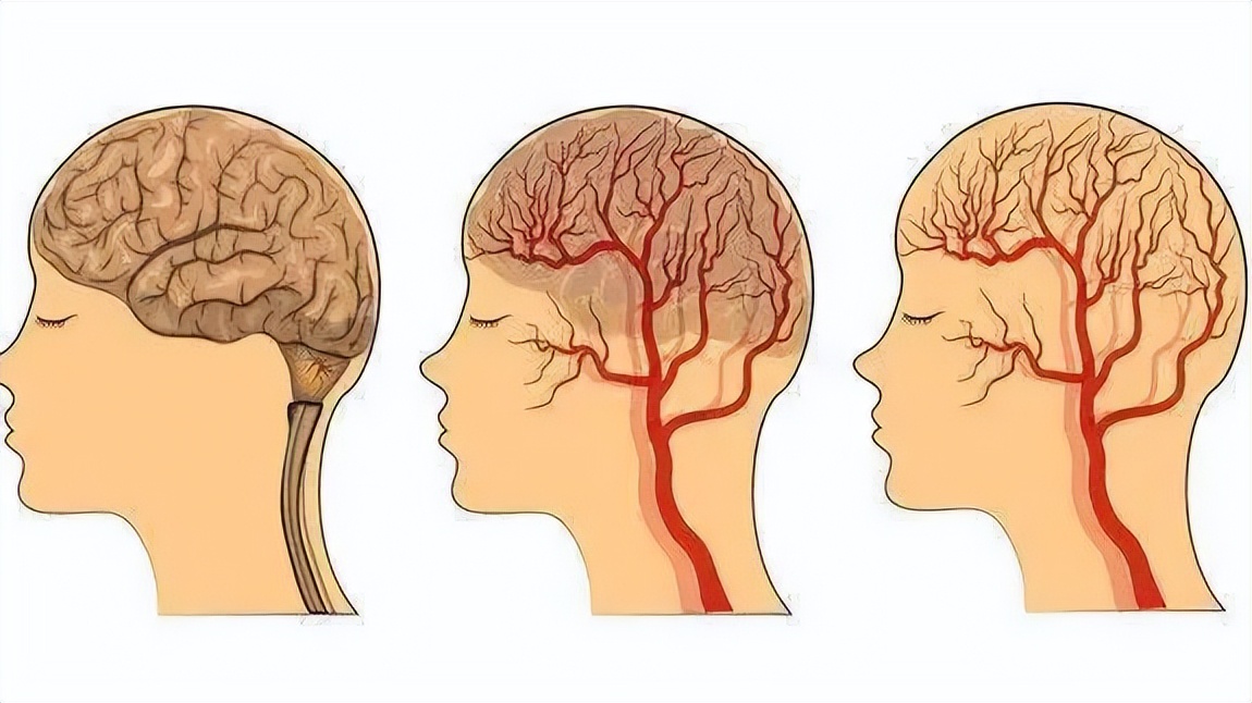 老年人心脏供血不足症状怎么调养,老年人心供血不足吃什么食物调养