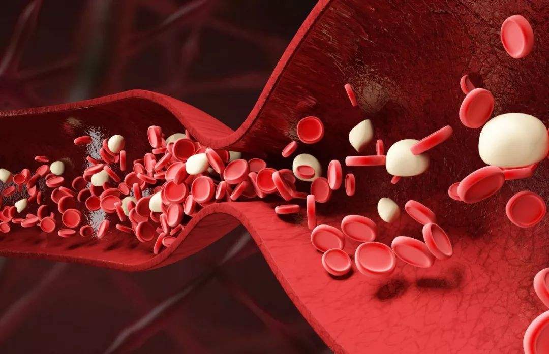 血瘀是导致高血压的根本原因,高血压血瘀有哪些中药能治好